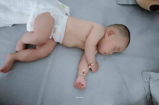 怒江六个月宝宝眼睛散光